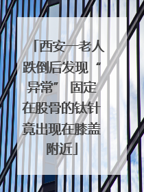西安一老人跌倒后发现“异常” 固定在股骨的钛针竟出现在膝盖附近